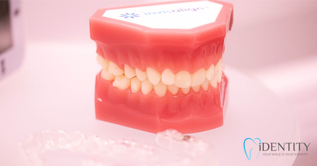 Лечение с алайнери Invisalign на атрактивна цена в гр. Варна - Дентална клиника IDENTITY от Д-р Ивелина Банчева