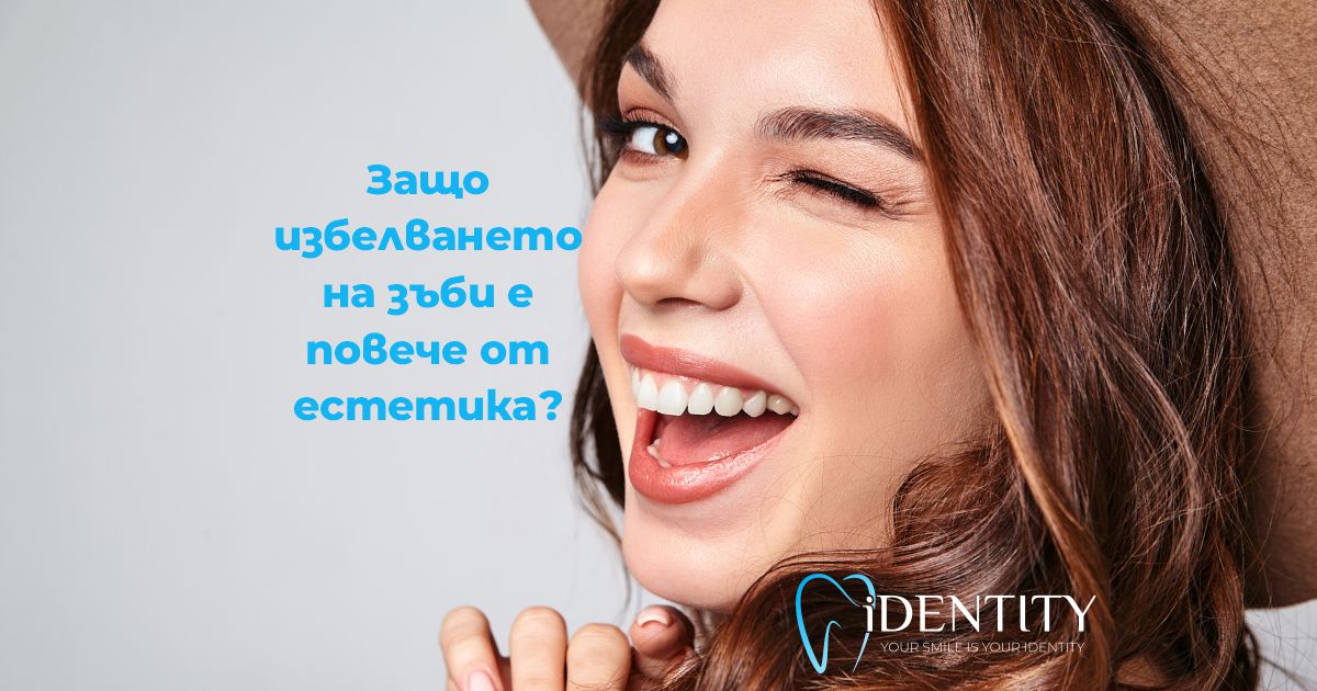 beli-zubi-identity-varna-01 Избелване на зъби на специална цена в гр. Варна - Дентална клиника IDENTITY от Д-р Ивелина Банчева